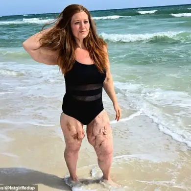 Lexi Reed’s Inspiring Journey from 22 Stone Weight Loss to Becoming a Body-Positivity Advocate