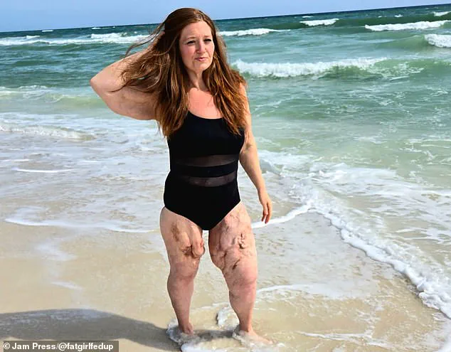 Lexi Reed’s Inspiring Journey from 22 Stone Weight Loss to Becoming a Body-Positivity Advocate