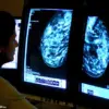 Study Links Oestrogen-Synthetic Progesterone HRT to 10% Higher Breast Cancer Risk in Women Under 55