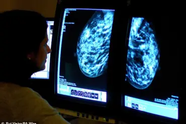 Study Links Oestrogen-Synthetic Progesterone HRT to 10% Higher Breast Cancer Risk in Women Under 55