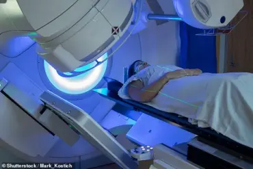 Study Suggests Potential Link Between Breast Cancer Radiotherapy and Reduced Alzheimer's Risk in Survivors