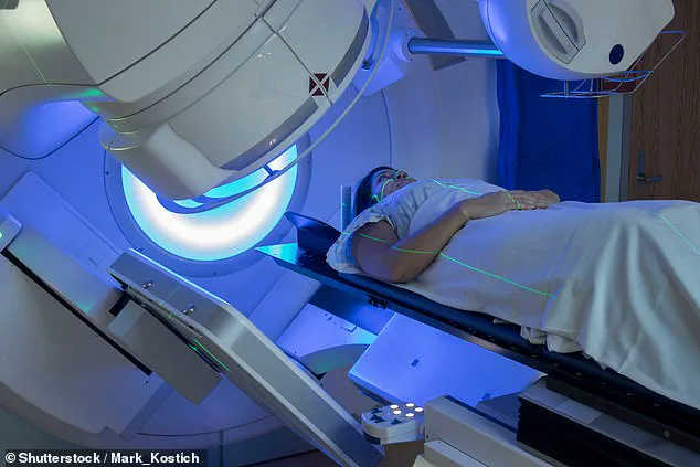 Study Suggests Potential Link Between Breast Cancer Radiotherapy and Reduced Alzheimer's Risk in Survivors