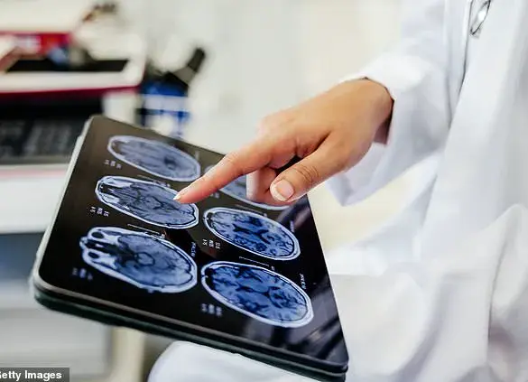 The Mystery of Deja Vu: Understanding a Common Yet Baffling Experience