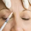 UK Health Security Agency Issues Urgent Alert Over Public Health Risks from Unlicensed Botox-Like Products