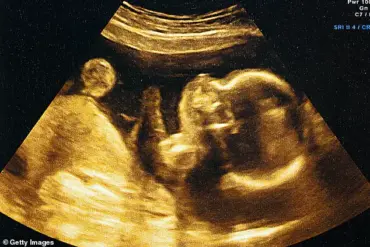 AI Revolutionizes Prenatal Care with 95% Accuracy in Predicting Birth Dates, Challenging Traditional Methods