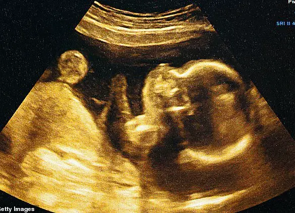 AI Revolutionizes Prenatal Care with 95% Accuracy in Predicting Birth Dates, Challenging Traditional Methods