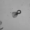 California Health Officials Issue Urgent Alert: Rare Raccoon Roundworm Infection Cases Prompt CDC Warnings