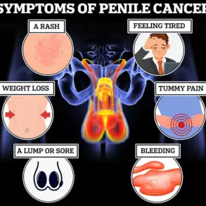Dr. Sooj Warns: 'Man Boobs' Could Signal Life-Threatening Diseases Like Cancer