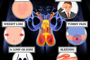 Dr. Sooj Warns: 'Man Boobs' Could Signal Life-Threatening Diseases Like Cancer