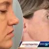 Exclusive: Internal Documents Reveal Secret Plastic Surgery Clinic's Hidden Risks in High-Profile Malpractice Case