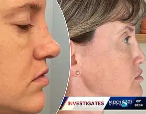 Exclusive: Internal Documents Reveal Secret Plastic Surgery Clinic's Hidden Risks in High-Profile Malpractice Case