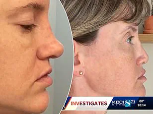 Exclusive: Internal Documents Reveal Secret Plastic Surgery Clinic's Hidden Risks in High-Profile Malpractice Case