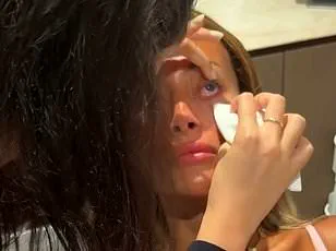 Health Experts Warn: Lash Serums Containing Prostaglandin Analogues May Cause Permanent Iris Darkening, Altering Eye Color