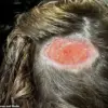 Kyrie Martin's Severe Chemical Burn from Hair Dye at Local Salon Leaves Permanent Bald Patch