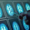 New Study Reveals 28% Surge in IBS Cases Post-Pandemic