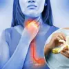 NHS Under Fire: Expert Warnings Highlight Crisis in Chronic Cough Care Amid Resource Shortages and Inconsistent Guidance
