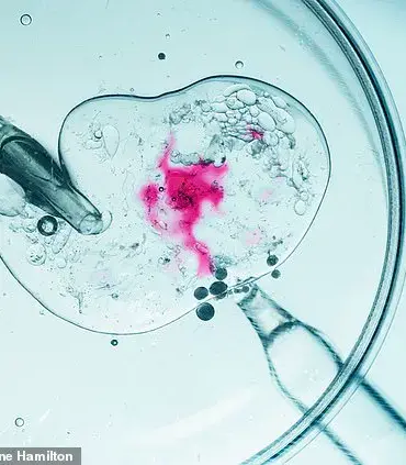 Seasonal Factors May Influence IVF Success Rates, Study Suggests