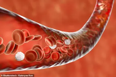 Study Reveals Link Between Mild Covid-19 and Accelerated Vascular Aging, Implications for Long-Term Health Risks
