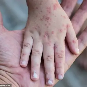 Surge in Legionnaires' and HFMD Cases Sparks Urgent Calls for Enhanced Public Health Measures in NYC and Beyond