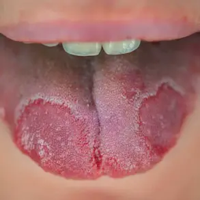 White Patches on the Tongue: Don't Ignore – Timely Evaluation is Key