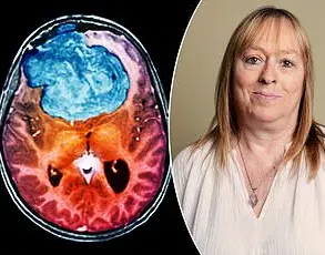 Study Sparks Debate on Hormonal Contraception's Link to Memory Loss